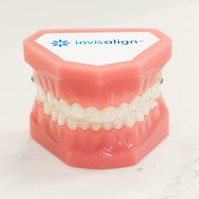 A model with clear aligners